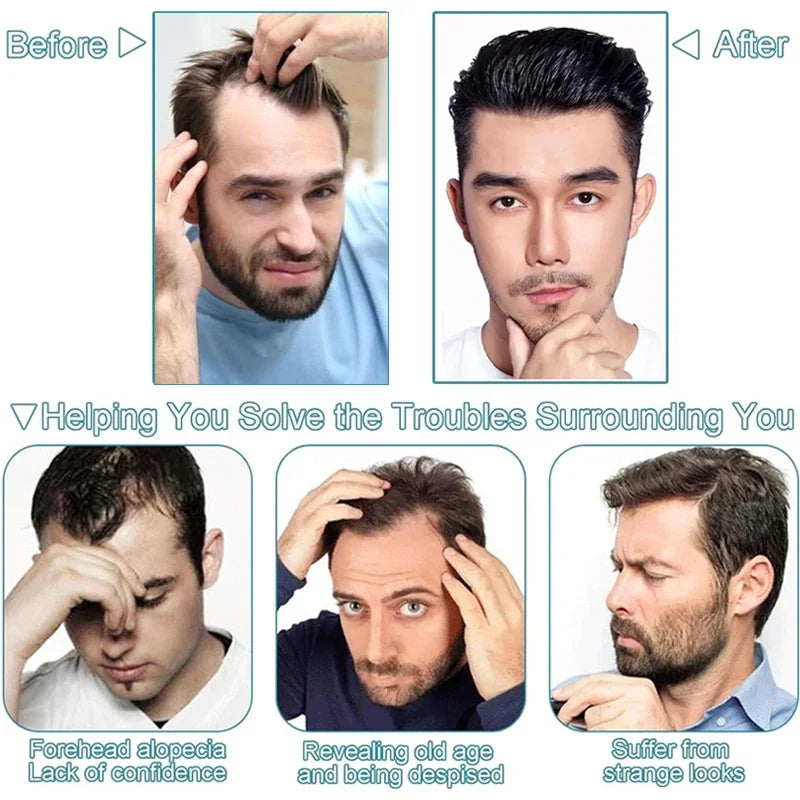 V Frontal Toupee for Men Wigs 2.5x16 Thin Skin PU V Loop Men Toupee Breathable V Style Front Wigs Blonde Color Forehead Hairline