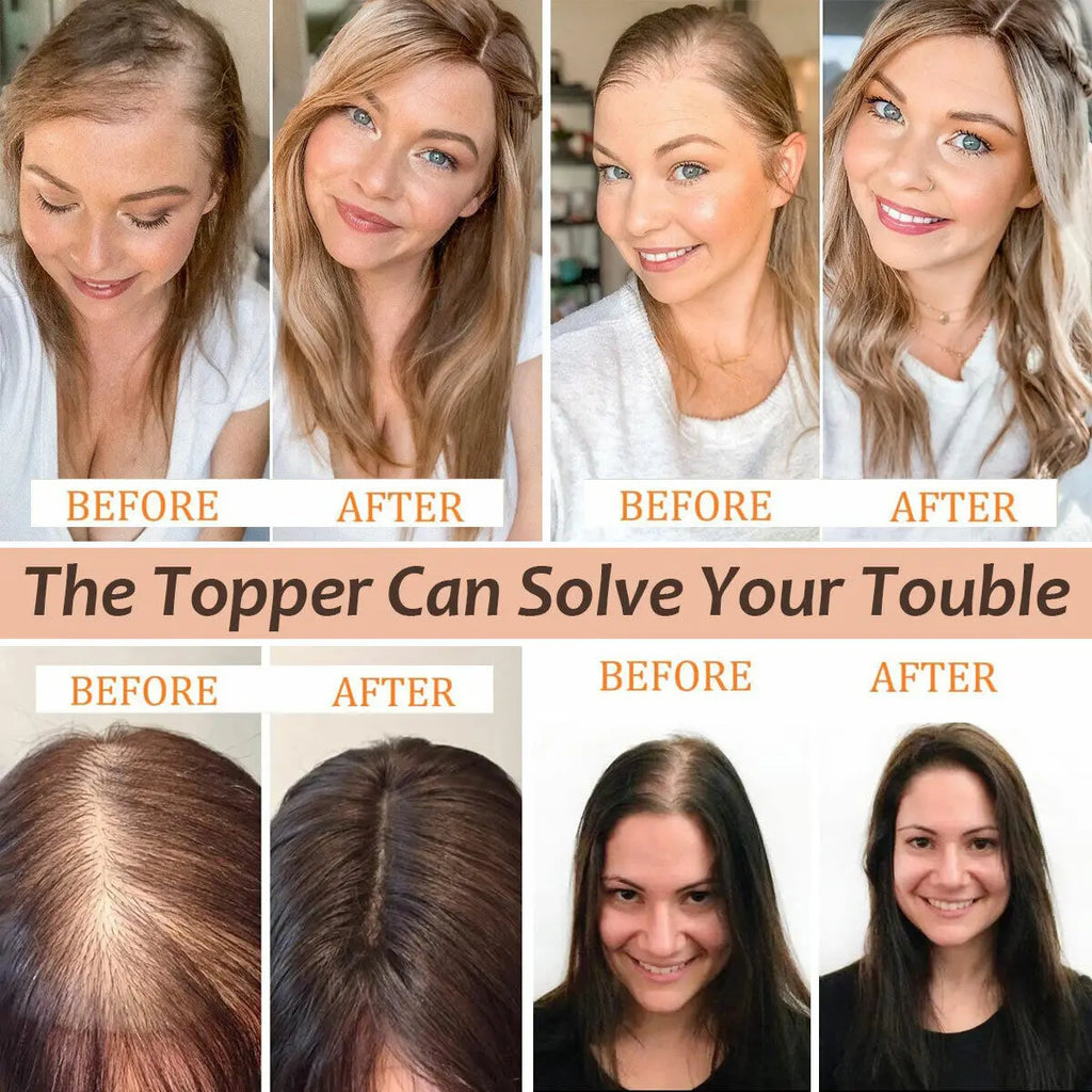 Human Hair Toppers Brown Natural Hair Wig For Women Clips In Hair Toppers 10'' Straight Hair Breathable Machine Made 7x11cm Base